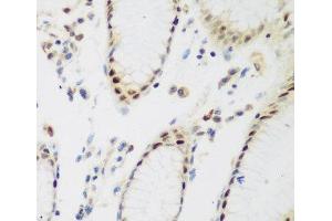 Immunohistochemistry of paraffin-embedded Human stomach using PPAN Polyclonal Antibody at dilution of 1:200 (40x lens). (PPAN anticorps)