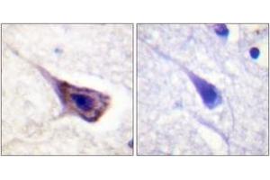 Immunohistochemistry analysis of paraffin-embedded human brain tissue, using BAD (Ab-134) Antibody. (BAD anticorps  (AA 100-149))