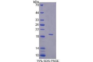 SDS-PAGE (SDS) image for serpin Peptidase Inhibitor, Clade A (Alpha-1 Antiproteinase, Antitrypsin), Member 6 (SERPINA6) (AA 218-378) protein (His tag) (ABIN1170231)