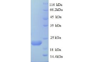 SDS-PAGE (SDS) image for Caspase 8 (CASP8) (AA 217-479) protein (His tag) (ABIN4984215)