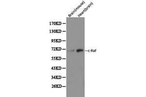 Western Blotting (WB) image for anti-V-Raf-1 Murine Leukemia Viral Oncogene Homolog 1 (RAF1) (C-Term) antibody (ABIN1874535) (RAF1 anticorps  (C-Term))