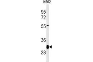 Western Blotting (WB) image for anti-Potassium Channel Tetramerisation Domain Containing 7 (KCTD7) antibody (ABIN3002217) (KCTD7 anticorps)