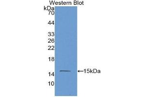 Western Blotting (WB) image for anti-Mannose Associated Serine Protease 2 (AA 170-287) antibody (ABIN1859762) (Mannose Associated Serine Protease 2 (AA 170-287) anticorps)