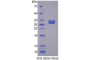 SDS-PAGE analysis of Human MECP2 Protein. (MECP2 Protéine)