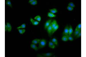 Immunofluorescence staining of HepG2 cells with ABIN7154988 at 1:100, counter-stained with DAPI. (HBG2 anticorps  (AA 2-147))