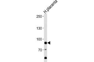 Western Blotting (WB) image for anti-Adenosine Monophosphate Deaminase 3 (AMPD3) antibody (ABIN3003542) (AMPD3 anticorps)