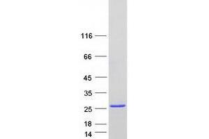 Validation with Western Blot