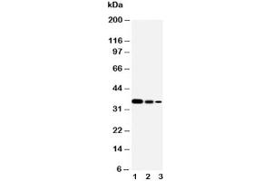 Western blot testing of Smad2 antibody and Lane 1:  Recombinant human  protein (10ng)