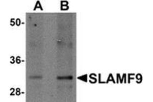 Western blot analysis of SLAMF9 in mouse kidney tissue lysate with SLAMF9 antibody at (A) 1 and (B) 2 μg/ml.