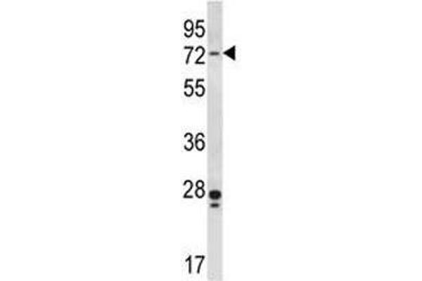 PAK4 anticorps  (AA 187-216)