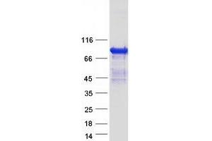 Validation with Western Blot