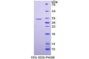 SDS-PAGE (SDS) image for Dopachrome Tautomerase (DCT) (AA 28-263) protein (His tag) (ABIN1878663) (DCT Protein (AA 28-263) (His tag))