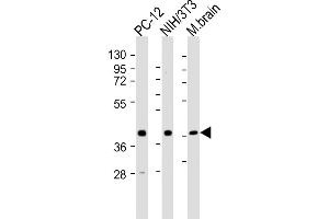 All lanes : Anti-Rnf2 Antibody (Center) at 1:2000 dilution Lane 1: PC-12 whole cell lysates Lane 2: NIH/3T3 whole cell lysates Lane 3: mouse brain lysates Lysates/proteins at 20 μg per lane. (RNF2 anticorps  (AA 198-232))