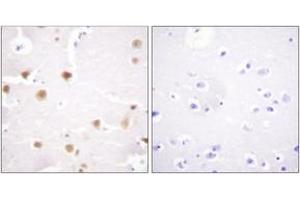 Immunohistochemistry (IHC) image for anti-Jun Proto-Oncogene (JUN) (AA 221-270) antibody (ABIN2888807) (C-JUN anticorps  (AA 221-270))