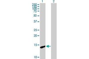 Western Blot analysis of CDA expression in transfected 293T cell line by CDA MaxPab polyclonal antibody. (CDA anticorps  (AA 1-146))