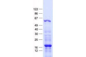 Validation with Western Blot