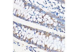 Immunohistochemistry of paraffin-embedded Human colon using ApoM Rabbit pAb (ABIN6127365, ABIN6137030, ABIN6137031 and ABIN6220968) at dilution of 1:50 (40x lens). (Apolipoprotein M anticorps  (AA 23-188))