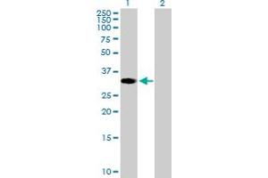 Western Blot analysis of ZNF101 expression in transfected 293T cell line by ZNF101 MaxPab polyclonal antibody. (ZNF101 anticorps  (AA 1-316))