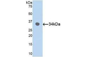 Detection of Recombinant MAPK9, Human using Polyclonal Antibody to Mitogen Activated Protein Kinase 9 (MAPK9)