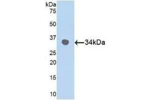 Detection of Recombinant MAPK9, Human using Polyclonal Antibody to Mitogen Activated Protein Kinase 9 (MAPK9) (JNK2 anticorps  (AA 130-387))