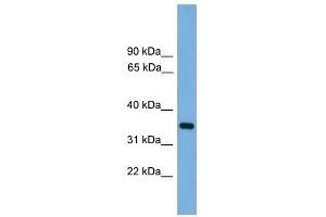 PRSS3 antibody used at 1 ug/ml to detect target protein.