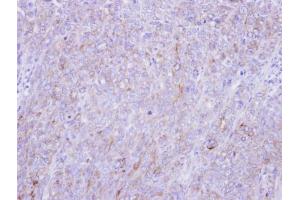 IHC-P Image Immunohistochemical analysis of paraffin-embedded DLD-1 xenograft, using Glypican-1, antibody at 1:100 dilution. (GPC1 anticorps)