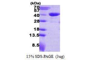 SDS-PAGE (SDS) image for Reticulon 4 Interacting Protein 1 (RTN4IP1) (AA 41-396) protein (His tag) (ABIN667646)