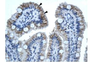 GJB1 antibody was used for immunohistochemistry at a concentration of 4-8 ug/ml to stain Epithelial cells of intestinal villus (lndicated with Arrows) in Human Intestine.