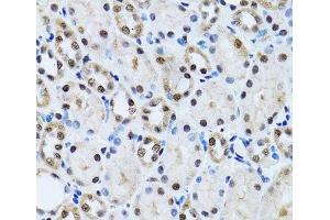 Immunohistochemistry of paraffin-embedded Rat kidney using CCAR2 Polyclonal Antibody at dilution of 1:100 (40x lens). (CCAR2 anticorps)