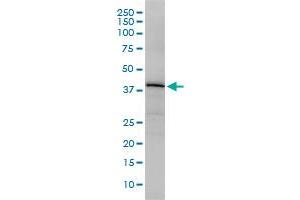 OBFC1 monoclonal antibody (M01), clone 3G12-1B7 Western Blot analysis of OBFC1 expression in Jurkat .