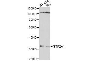 Western blot analysis of extracts of various cell lines, using GTF2A1 antibody (ABIN1876533) at 1:1000 dilution. (GTF2A1 anticorps)