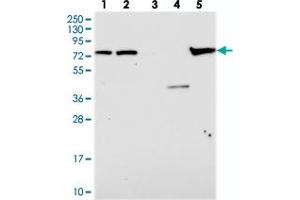Western blot analysis of Lane 1: RT-4, Lane 2: U-251 MG, Lane 3: Human Plasma, Lane 4: Liver, Lane 5: Tonsil with KBTBD8 polyclonal antibody .