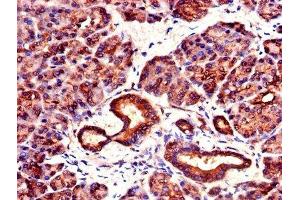 IHC image of ABIN7142105 diluted at 1:1000 and staining in paraffin-embedded human pancreatic tissue performed on a Leica BondTM system. (14-3-3 zeta anticorps  (AA 133-212))