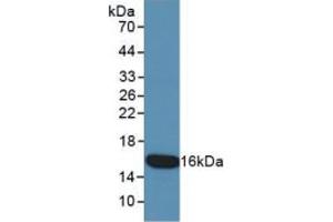 WB of Protein Standard: different control antibodies against Highly purified E.