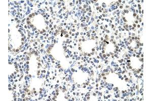 PRMT5 antibody was used for immunohistochemistry at a concentration of 4-8 ug/ml to stain Alveolar ceils (arrows) in Human Lung. (PRMT5 anticorps  (N-Term))