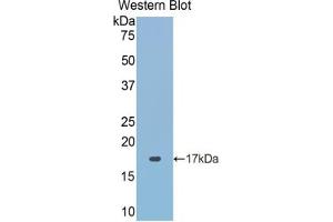 Western blot analysis of the recombinant protein. (ACP1 anticorps  (AA 40-158))