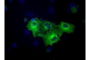 Immunofluorescence (IF) image for anti-Fermitin Family Member 2 (FERMT2) antibody (ABIN1499049) (FERMT2 anticorps)