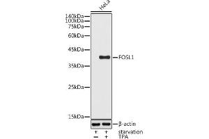 Western blot analysis of extracts of HeLa cells, using FOSL1 antibody (ABIN6131653, ABIN6140738, ABIN6140739 and ABIN6221016) at 1:1000 dilution.