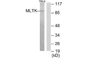 Western Blotting (WB) image for anti-Mitogen-Activated Protein Kinase Kinase Kinase MLT (ZAK) (C-Term) antibody (ABIN1850018)