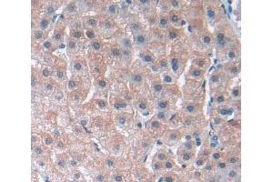 Used in DAB staining on fromalin fixed paraffin- embedded liver tissue (PLA2G3 anticorps  (AA 20-268))
