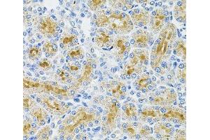 Immunohistochemistry of paraffin-embedded Rat kidney using DDX20 Polyclonal Antibody at dilution of 1:100 (40x lens). (DDX20 anticorps)