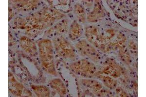 IHC image of ABIN7127662 diluted at 1:100 and staining in paraffin-embedded human kidney tissue performed on a Leica BondTM system.