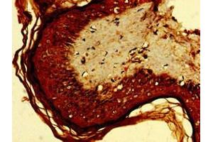Immunohistochemistry of paraffin-embedded human skin tissue using ABIN7167795 at dilution of 1:100