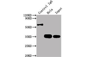Immunoprecipitating CDK4 in Hela whole cell lysate Lane 1: Rabbit control IgG instead of ABIN7127418 in Hela whole cell lysate. (Recombinant CDK4 anticorps)