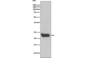 Western blot analysis of Interferon beta expression in HeLa cell lysate.