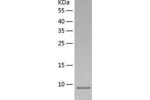 Western Blotting (WB) image for Pterin-4 alpha-Carbinolamine Dehydratase/dimerization Cofactor of Hepatocyte Nuclear Factor 1 alpha (PCBD1) (AA 1-104) protein (His-IF2DI Tag) (ABIN7124707)