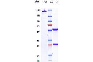 Anti- Human CLDN18. (Recombinant CLDN18.2 (Zolbetuximab Biosimilar) anticorps)