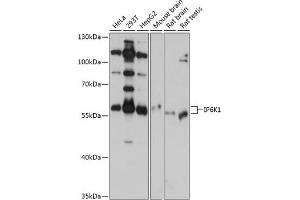 Western blot analysis of extracts of various cell lines, using IP6K1 antibody (ABIN6131922, ABIN6142500, ABIN6142501 and ABIN6215821) at 1:1000 dilution. (IP6K1 anticorps  (AA 1-220))