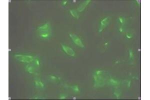 Immunofluorescence staining of human LNCap cell colony with monoclonal anti- human STEAP1 antibody. (STEAP1 anticorps  (AA 1-70))