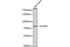 Western blot analysis of extracts of rat heart, using NU antibody (ABIN7268966) at 1:1000 dilution. (NUAK1 anticorps  (AA 362-661))